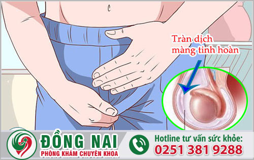 Biến chứng nguy hiểm của tràn dịch màn tinh là gì?