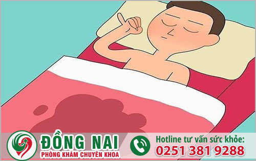 Tại sao nam giới lại bị tình trạng mộng tinh?